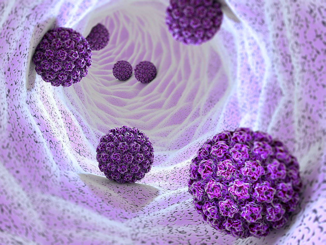 什么是尖锐湿疣，有什么症状？